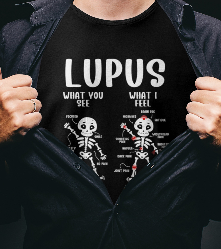 Lupus Awareness Skeleton Diagram What You See What I Feel Pain Points T-Shirt