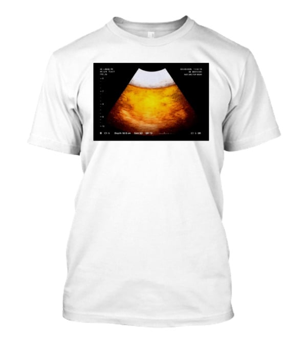Beer Ultrasound Image Not Safe For Liver T-Shirt
