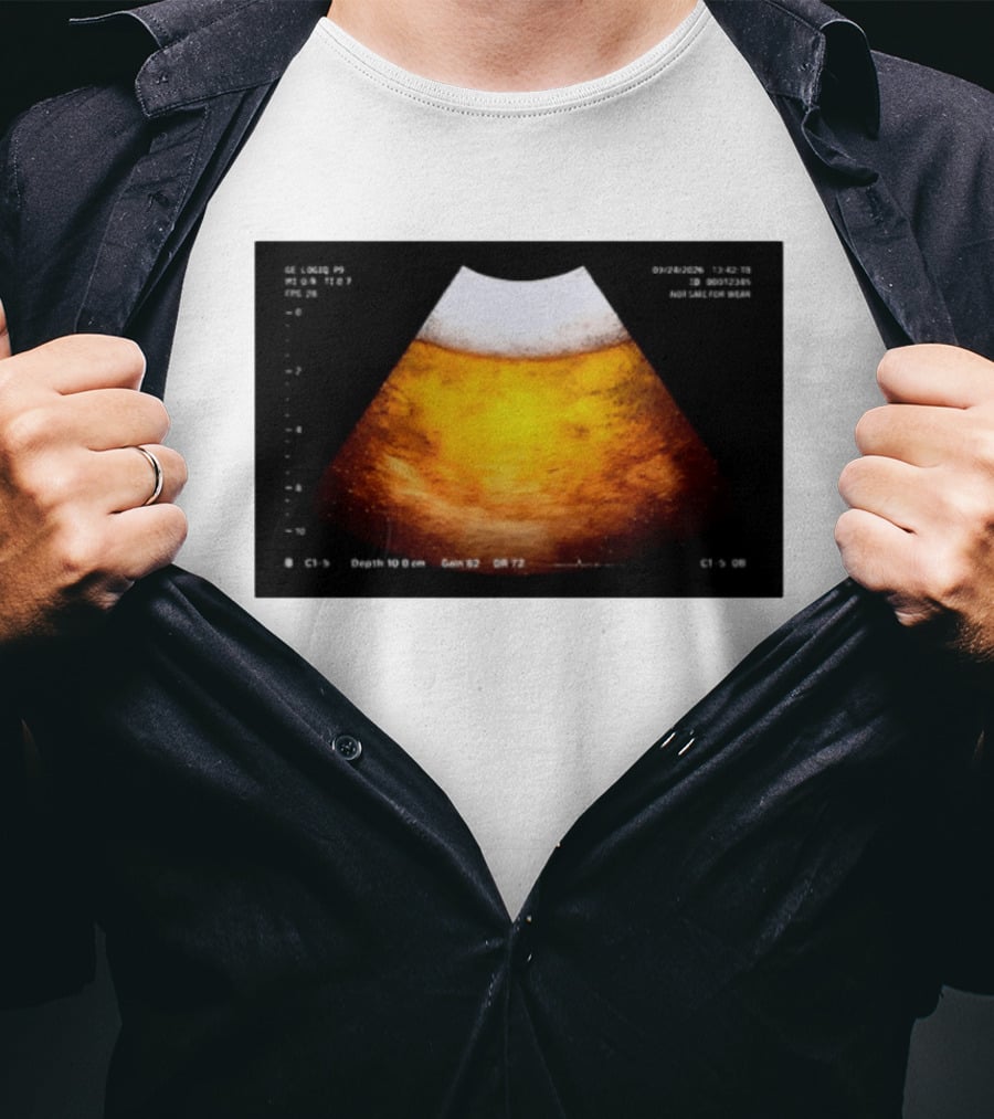 Beer Ultrasound Image Not Safe For Liver T-Shirt
