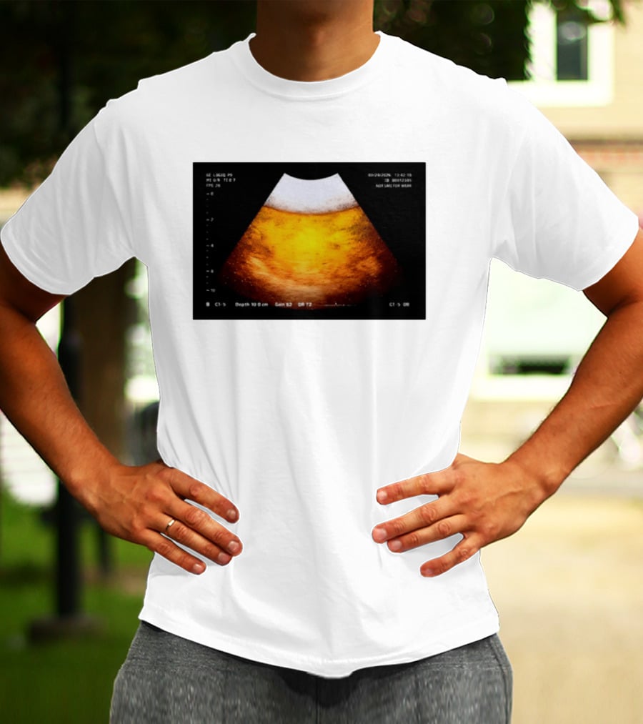 Beer Ultrasound Image Not Safe For Liver T-Shirt