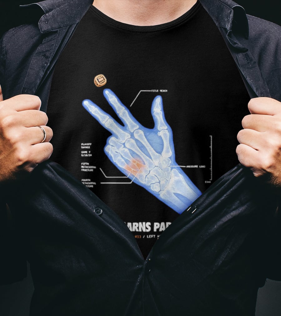 Pain Earns Parades X Ray Left Hand Study Detailed Anatomy T-Shirt