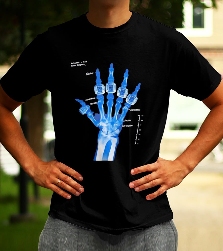 Kobe Bryant Patient No 24 X Ray Rings Lakers T-Shirt