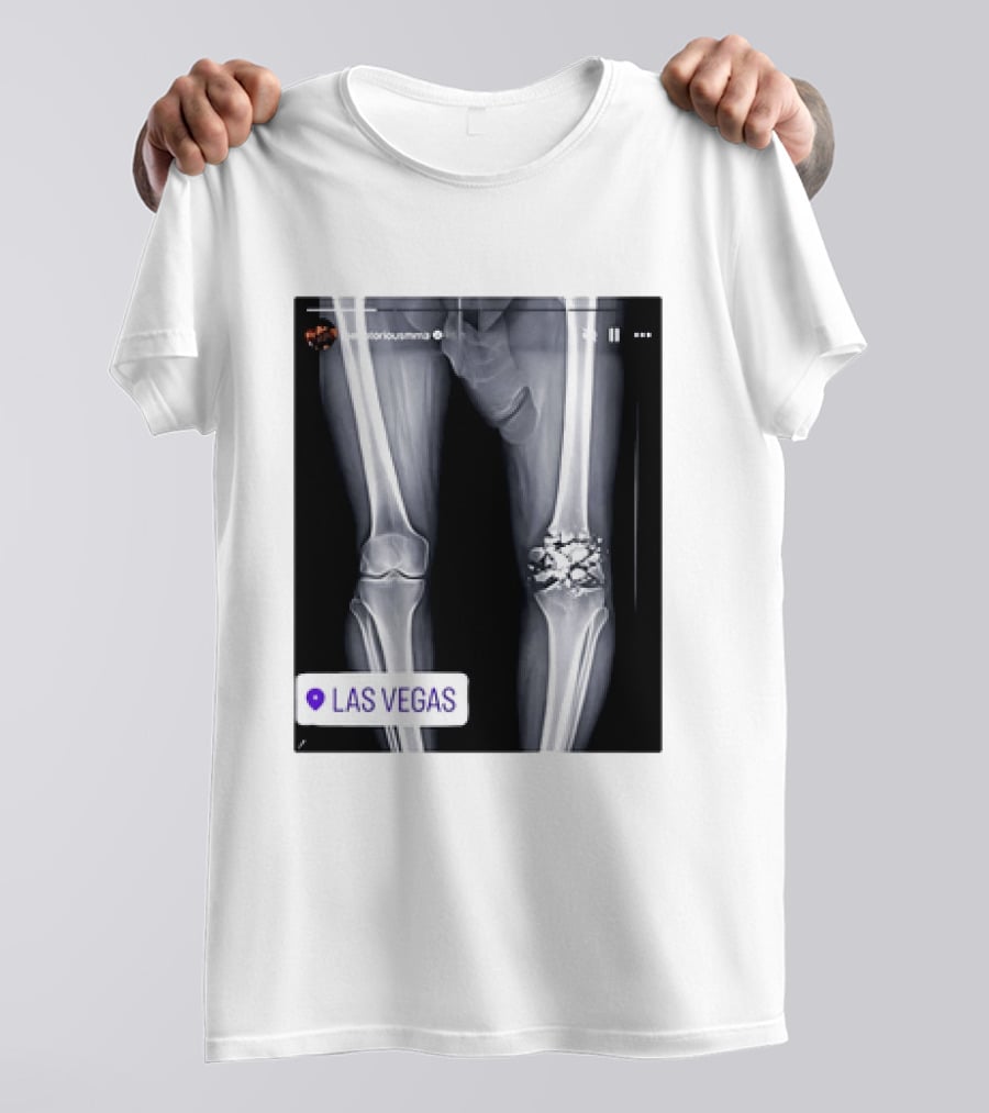 Conor McGregor X Ray Broken Knee Las Vegas T-Shirt